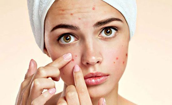 ترفندهای آرایشی برای پوشاندن جوش صورت