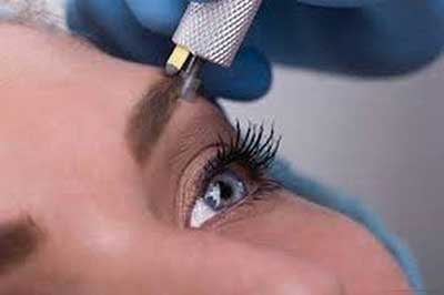 میکروبلیدینگ ابرو چیست و چه تفاوتی با میکروپیگمنتیشن دارد؟