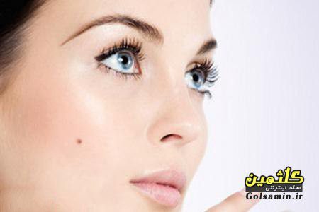 خال صورت را چگونه از بین ببریم؟