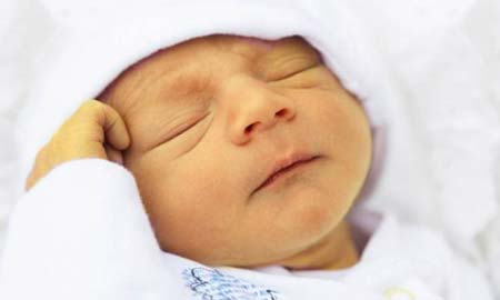 درمان خانگی زردی نوزاد
